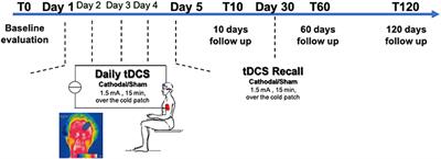 Cathodal tDCS Guided by Thermography as Adjunctive Therapy in Chronic Migraine Patients: A Sham-Controlled Pilot Study